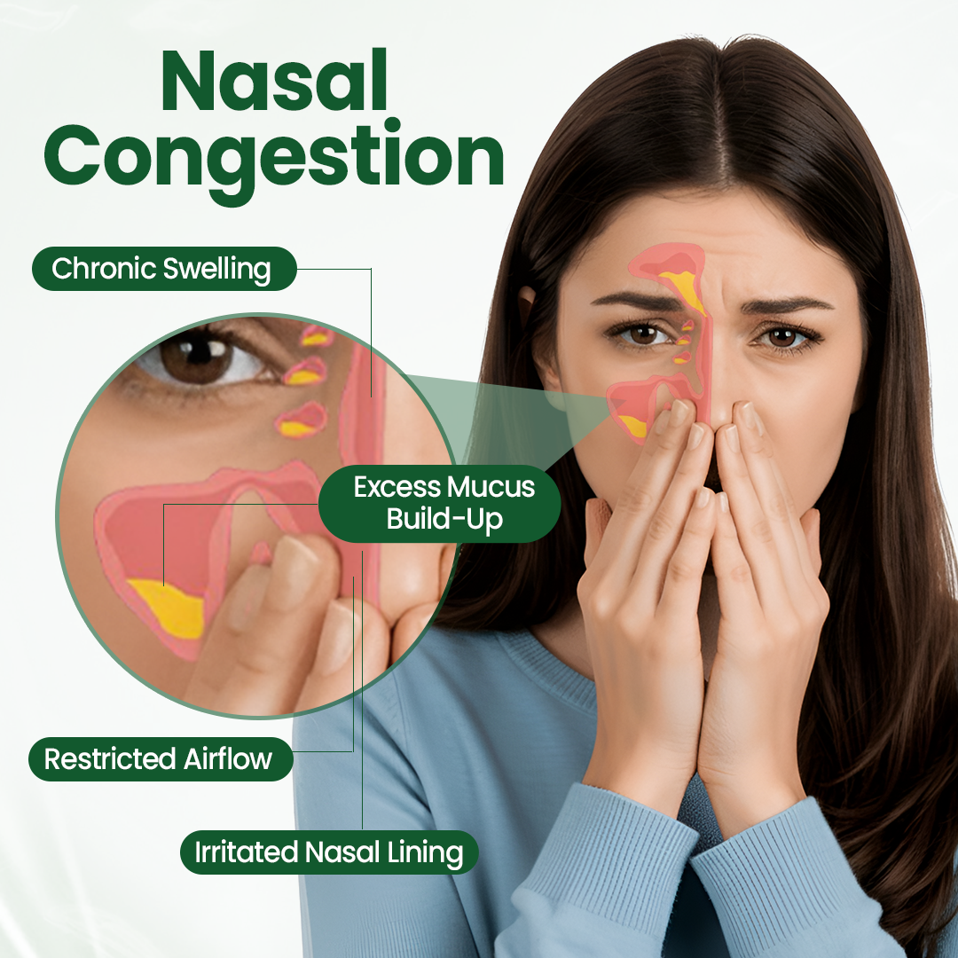 Timilk® RhiniThera Nasal Spray