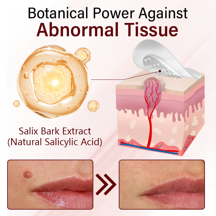 Timilk® Vionara Nano WartErase Patch-