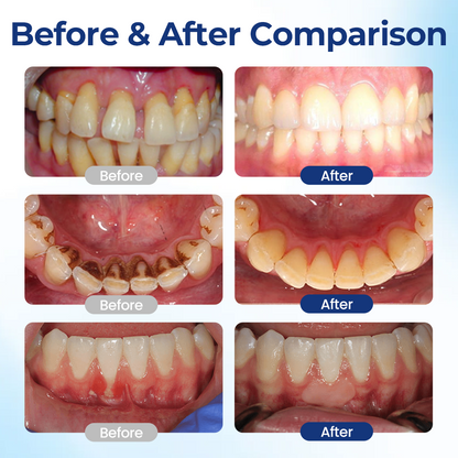 Biancat® BeeTakt Oral Repair Solution